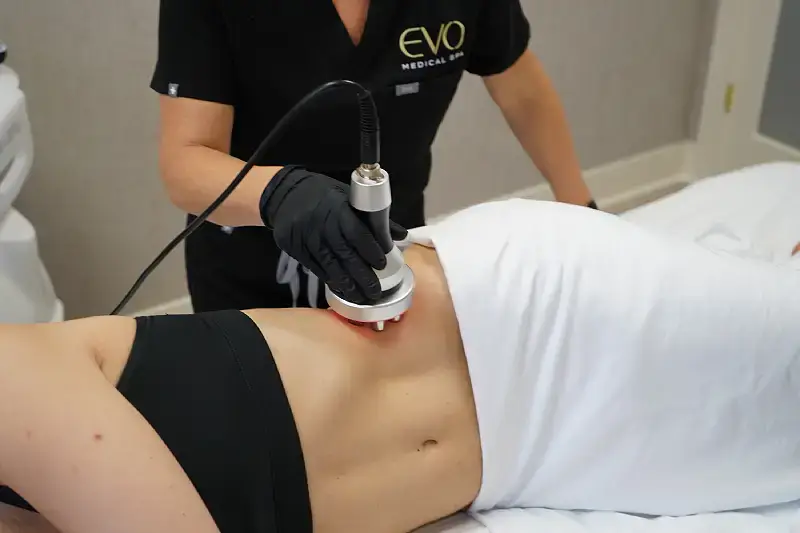 An EVO provider performing an InstaSculpt body contouring treatment on a patient’s stomach