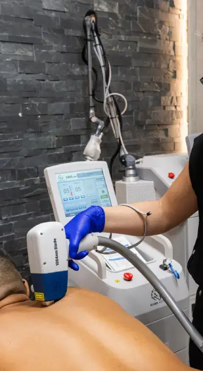 A licensed provider performing laser hair removal